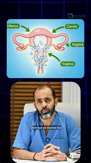 White Vaginal Discharge normal or infection?Leucorrhoea,yeast infection and vaginal health explained
