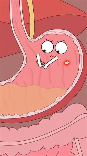 Vital Signs 🫀 on Instagram: "My Stomach is Having a Meltdown! 🍺🔥 | Ever wondered what a night of heavy drinking REALLY does to your stomach? This animation takes you inside for a front-row seat to the chaos! From patching up ulcers to dealing with a flood of mixed drinks, the stomach is fighting a losing battle. When the esophagus and stomach finally give up, it’s a race to the hospital. See the shocking moment a doctor reveals a perforated stomach—all from one wild night. A funny but serious