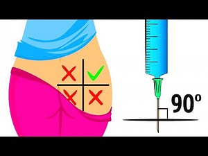 Aplicación correcta de inyección intramuscular en glúteo