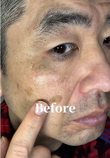 Effective Skincare Tips to Reduce Wrinkles and Spots