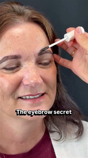 The Eyebrow Procedure Everyone’s Talking About!