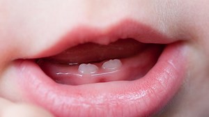 When do babies start teething and what can be done to soothe their pain?