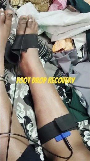 How to Treat Muscle Weakness? | Physiotherapy Treatment for Foot Drop #short #physicaltherapy