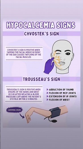 Sign of hypocalcemia | Chvostek's Sign | trousseau's Sign | AIIMS EXAM | RRB | ESIC #calcium #nurse