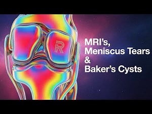 MRI's, Meniscus Tears & Baker's Cysts