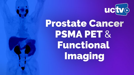 VIDEO: Prostate Cancer: PSMA PET and Functional Imaging