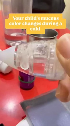 🩺✨ Mucous Color Changes During a Kid's Cold! ✨🩺 Did you know? The color of your child's mucus can tell a story about their cold: 🔹 Transparent: Normal, clear mucus; the body’s way of staying hydrated and healthy. 🔸 White: Indicates congestion or thickening, often during the early stages. 🟡🟢 Yellowish-Green: Signs that the immune system is fighting off infection; white blood cells are at work! It doesn't mean you need antibiotics ! 🚫🚫 🔄 Back to Transparent: Once the infection clears, muc