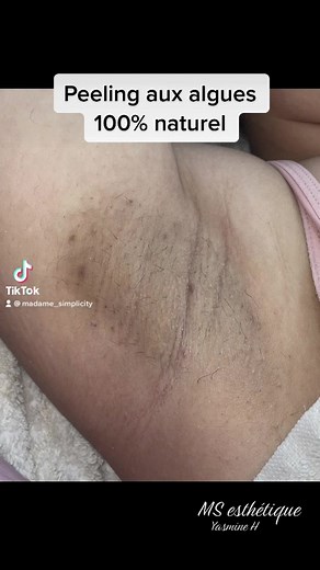 6.2K views · 116 reactions | #PeelingAuxAlgues #promo sur toutes les parties du corps #annaba #welcome #58wilayas prenez rendez-vous en appelant le 0798581215 | Yasmine Haddada Machta Makeup Artist - madame simplicité | Facebook