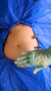 A Step-by-Step Look Inside Surgery | Green Bean