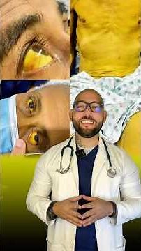 Ictericia: qué es y por qué aparece la piel amarilla