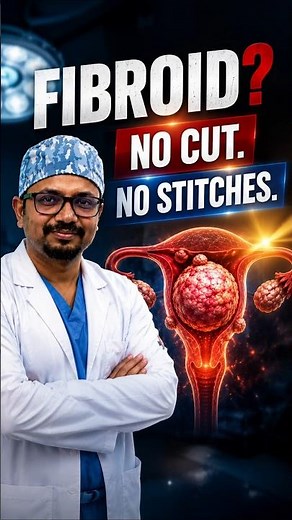Shrink Uterine Fibroids WITHOUT Surgery! #UFE #FibroidTreatment