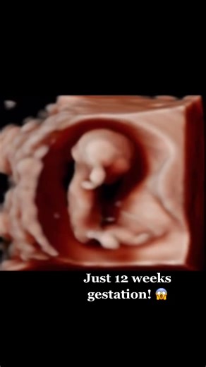 Can you believe this little babe is only 12 weeks gestation?! Look at those arms and legs dancing around! 🤍 #12weekspregnant #hellobabyburlington #hellobaby #keepsakeultrasound #keepsake #maternity #pregnancy #4Dultrasound #ultrasound #3dultrasound #sonogram #ultrasoundtech hellobabyburlington.com ✨