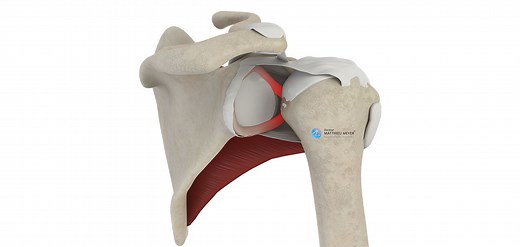 Arthroscopic Capsulolabral Repair (Bankart Procedure) - Doctor Matthieu Meyer