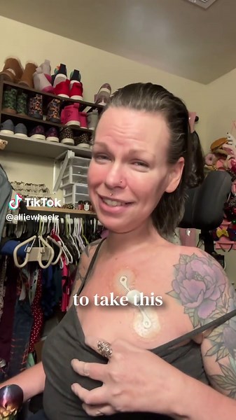 Me vs. the Zio patch: it’s been real, it’s been itchy, and my skin can finally breathe again 😂💖 freedom never felt so good #ZioMonitorLife