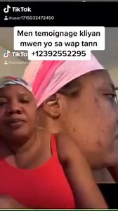 2.1K views · 17 reactions | Men temwanyaj kliyanm depi 2020 | Anny naturals | Facebook