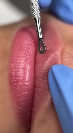 How to Remove Blackheads From Lips | Face Cleaning Tips