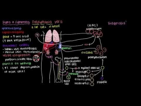 What is polycythemia vera?