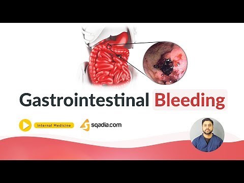 Gastrointestinal Bleeding | Medicine Online Education | Medical Lectures | V-Learning