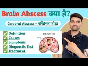 Brain Abscess Lecture in Hindi | Causes, Symptoms And Treatment of Brain Abscess