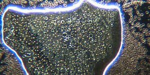 Astonishing Darkfield Live Blood Footage Of Nano/Microrobots In C19 Unvaccinated Blood And What did Ray Kurzweil Say About Nanorobots And the Singularity?