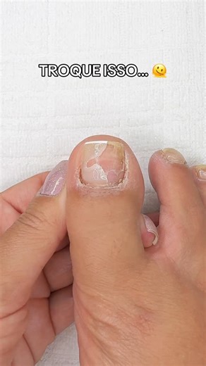 Larissa Leite Unhas | Troque essa esmaltação toda acabada já 🫠🦶🏼 Por um gorrinho de Natal com esmaltes branco e vermelho Cole o ID no buscador do Mercado... | Instagram