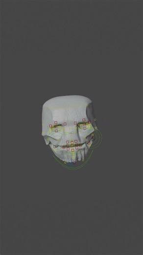 Hugo expression test