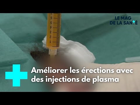 Plasma injections to treat erectile dysfunction - Health Magazine