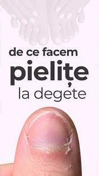 PIELIȚE la degete, DE CE ? 💅🏼 🤷‍♀️