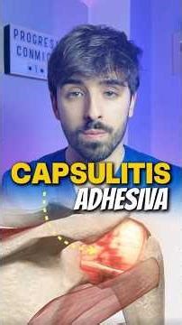 ADHESIVE CAPSULITIS What can you start doing?