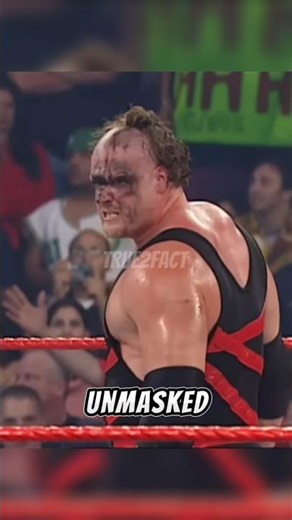 Kane Unmasked for first time 😦