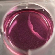 Video: Tissue Engineering of Tumor Stromal Microenvironment with Application to Cancer Cell Invasion