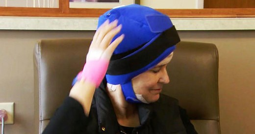 Cold caps help cancer patients keep their hair