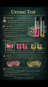 62K views · 815 reactions | Biochemical test ❣️ #microbiology #laboratorymedicine #medicallaboratoryscience #lablife #Diagnosis | Lab life | Facebook