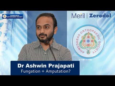 Fungating Bone Tumors: Why Amputation Isn't Always the Answer | Dr. Ashwin Prajapati
