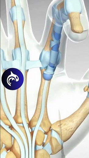 See how a Trigger Finger is released - 3D Animation #hand #orthopedics