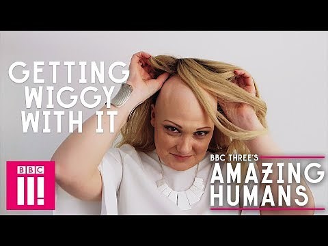 The Inspiring Woman Helping Others Battling Baldness