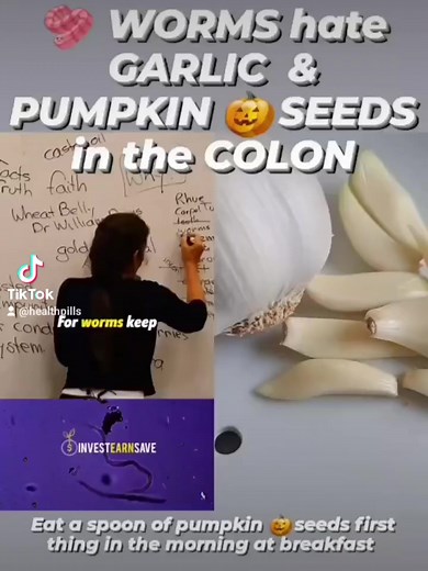 Garlic and Pumpkin seeds are natural Wormkiller- nematodes, tapeworms, giardiasis, pinworms etc. Worms are formed in the intestines due to eating a lot of sugar, refined junk foods, conventional wheat, lot of meat. They causes Constipation and provide a breeding ground for worms to flourish. But eating a lot of veggies as a part of diet helps Normalise bowel movement 1-2x a day. Garlic and Pumpkin seeds are two home remedies for throwing out worms from the body #wormkiller #antiparasiticherb #pa