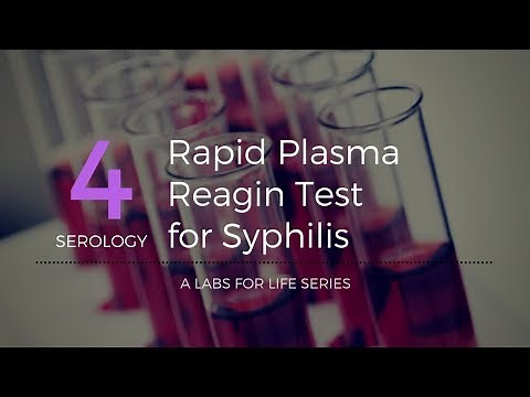 Rapid Plasma Reagin Test for Syphilis