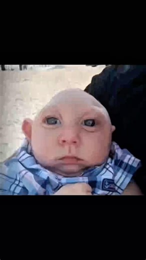 People missing body parts 😳 #curiosities #shorts