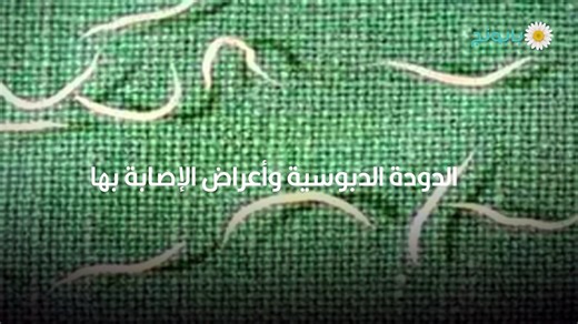 الديدان الدبوسية