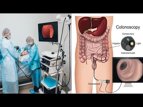 COMBINED GASTROSCOPY & COLONOSCOPY