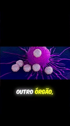 Entenda de forma simples: o que realmente acontece na metástase?