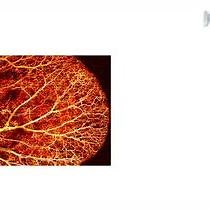 Video: Three-dimensional Optical-resolution Photoacoustic Microscopy