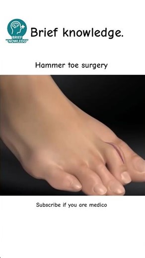 Why Is This Toe Bent Like This? 😳🦶