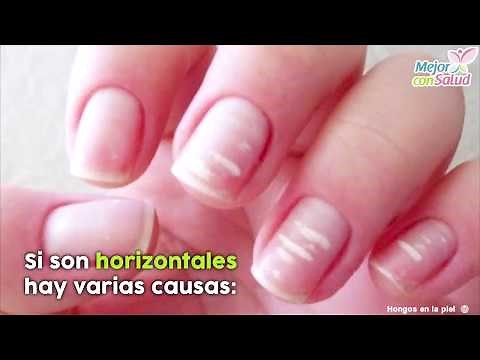 Líneas blancas en las uñas, ¿por qué salen? - Mejor con salud