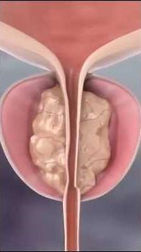 Never Hold Your Fart After Watching This 😨 #healthfacts #humanbody #shorts