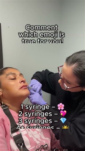 We’re curious … 💋 How many lip filler syringes have you tried?