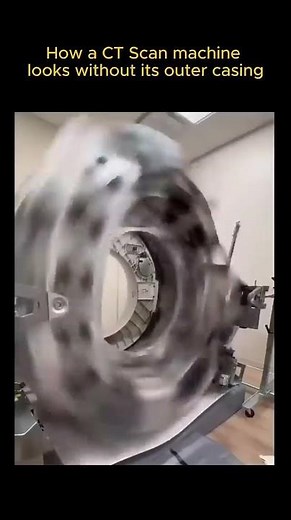 The Incredible Engineering Behind CT Scanner Technology 👇