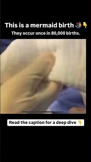 Mermaid births do exist
