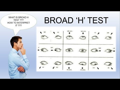 Broad H Test | Ocular Motility Test.